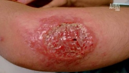Background image for Flesh Eaters