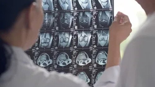 Shaken Baby Syndrome