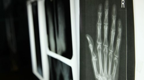 Background image for The Incredible Human Hand