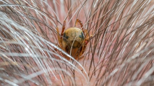 Tick Meat Allergy, Alien Technology