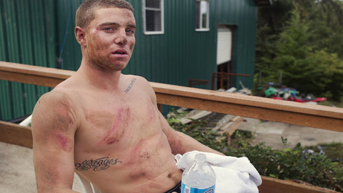 King of the Road Season 2016 Episode 4 - Possible Broken Cheekbone