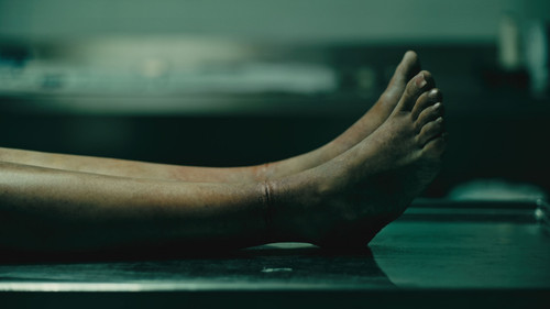 El forense Season 1 Episode 2 - Episode 2