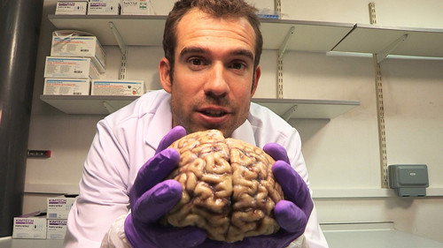 Operation Ouch! Season 1 Episode 2 - Your Brilliant Brain