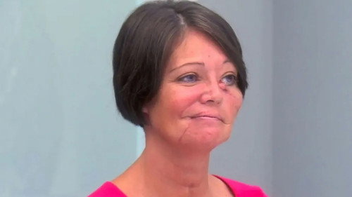 Botched Season 6 Episode 18 - Hopeful Transformations