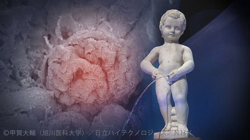 NHK Special Season 2017 Episode 1001 - Episode 1001