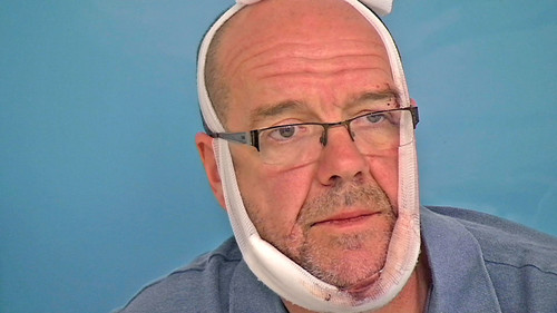 24 Hours in A&E Season 10 Episode 3 - Always On My Mind