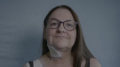 The Face Doctors Season 1 Episode 5 - Hole in The Face