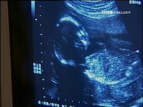Child of Our Time Season 1 Episode 1 - Babies