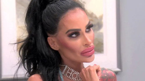 Botched Season 6 Episode 19 - Necrotic Nightmare