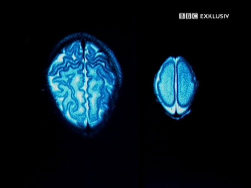 Child of Our Time Season 2 Episode 2 - Brain Magic