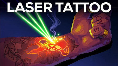 Kurzgesagt - In a Nutshell Season 13 Episode 24 - Tattoo Removal Is Insane