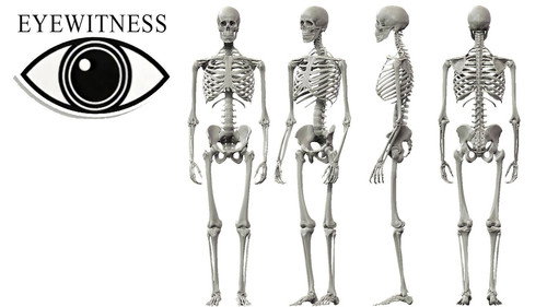 Eyewitness Season 1 Episode 13 - Skeleton