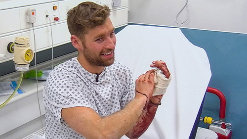 24 Hours in A&E Season 22 Episode 4 - Skin Deep
