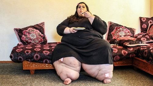 My 600-lb Life Season 3 Episode 1 - Amber's Story