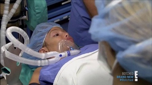 Botched Season 1 Episode 3 - Vagina Bomb!