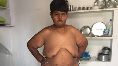 Body Bizarre Season 6 Episode 7 - Boy with no eyes