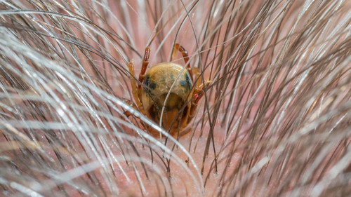 Catalyst Season 16 Episode 3 - Tick Meat Allergy, Alien Technology