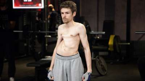 Body Bizarre Season 6 Episode 2 - My Body is Eating my Bones