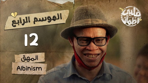 My Heart Relieved Season 4 Episode 12 - Albinism