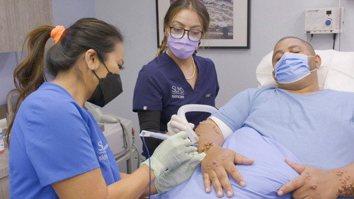 Dr. Pimple Popper Season 8 Episode 4 - Alligator Arms