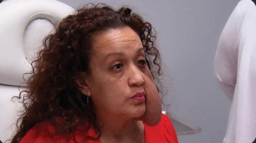 Botched Season 8 Episode 20 - Tumor Tragedy