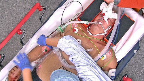 24 Hours in A&E Season 10 Episode 14 - Stronger Together