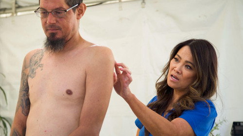 Dr. Pimple Popper Season 9 Episode 18 - California Bumpin'