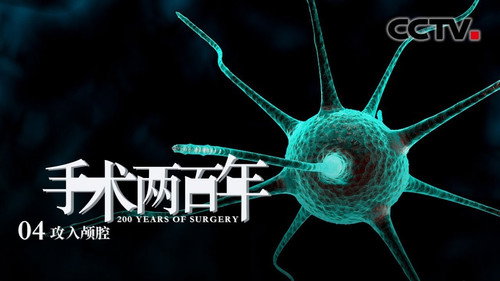 Two Hundred Years of Surgery Season 1 Episode 4 - Exploring the Brain