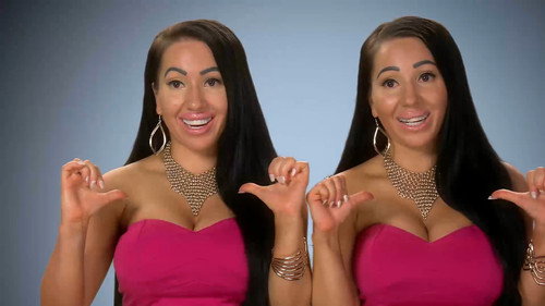 Botched Season 3 Episode 7 - Seeing Double